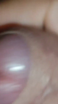 Amazing Dilator Vessel Has Disproportionate Increase.