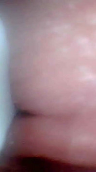 Endoskopkamera visar de känsligaste delarna av penis utbildningsvideo