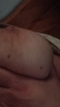 Brustmassage chuyên sâu