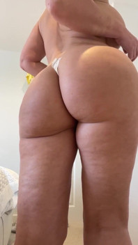 Operația mea secretă de chirurgie cosmetică