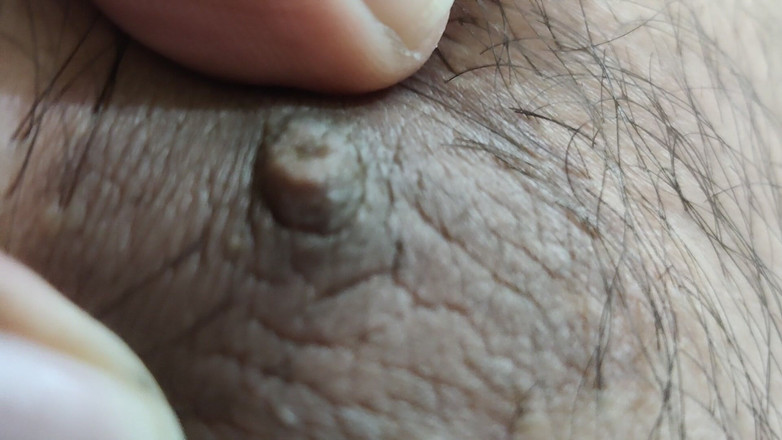 Mysterious island: The Night