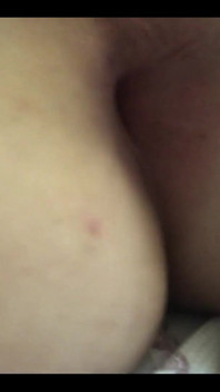 My hole today