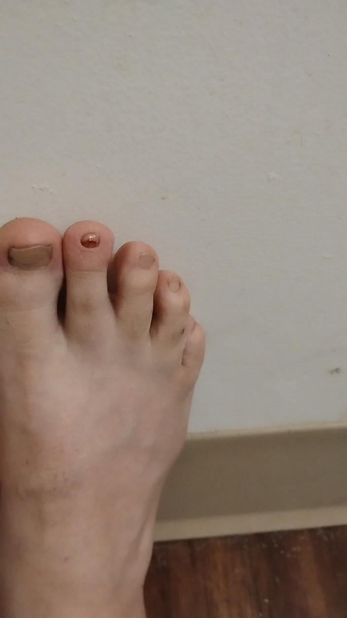 JG Risk: 2025-11-26 可爱的小脚趾