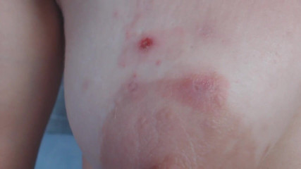 Miodelka: My saggy tits served as an ashtray and Showing how...