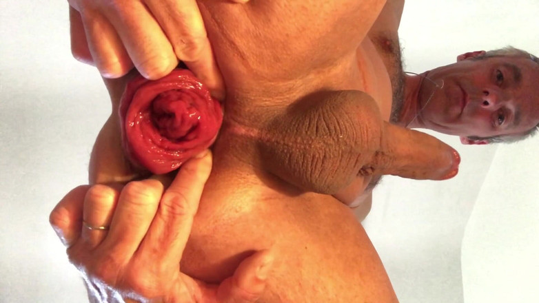 Jardinsecret346: Una impressionante dilatazione anale dopo un duro inserimento