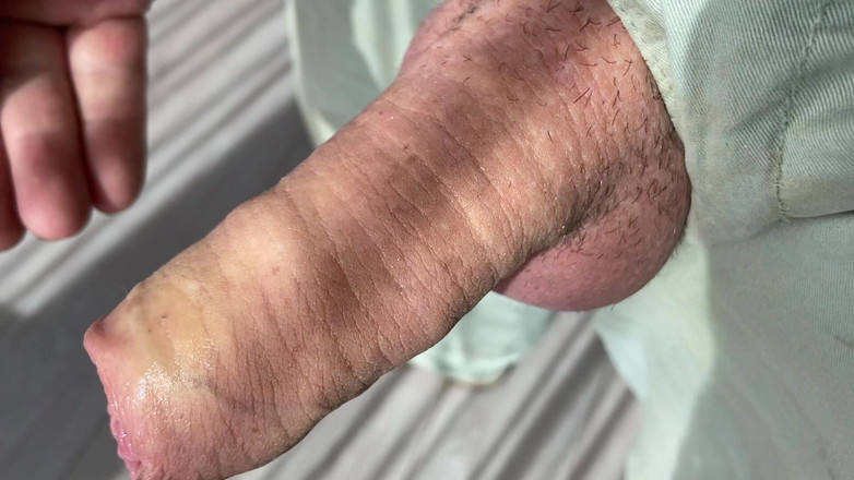 Foreskinguy: Cận cảnh sục con cu nấm khổng lồ chưa cắt