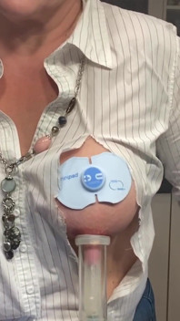 49 岁熟女仍然用奶瓶装母乳