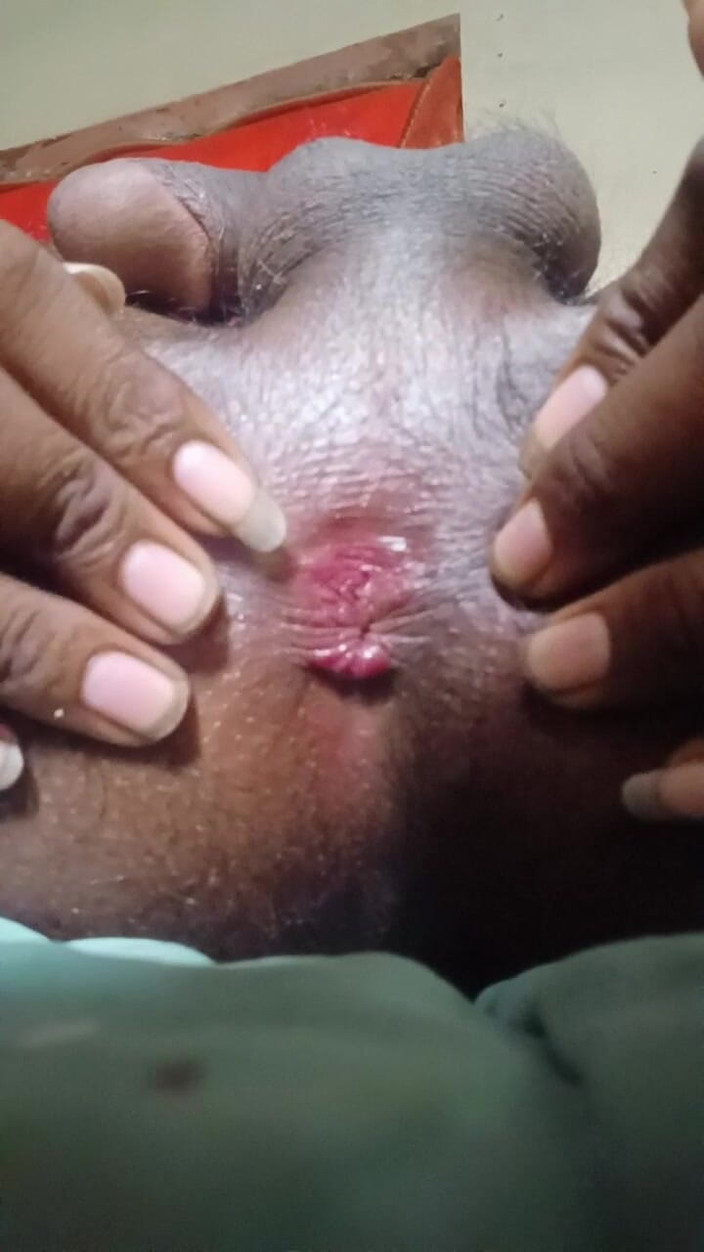 Arvind6355: J’ai aimé me mettre ma propre bite dans le cul