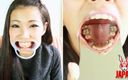 Japan Fetish Fusion: Ortho Obsession: Moja podróż z aparatami ortodontycznymi