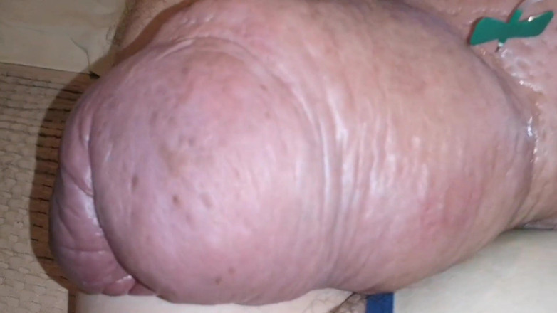 Monster_Meat_: Ogromny wzrost przez glukozy