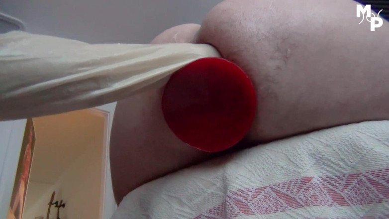 Marcus Pollack Gay: Biến cái mông thành một cái mông hồng
