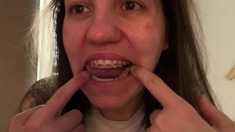 NicoleRay: Olizování rovnátek jazykem