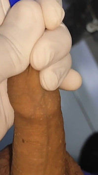 In a Doctor's Office I Apply Hot Glue to My Dick.