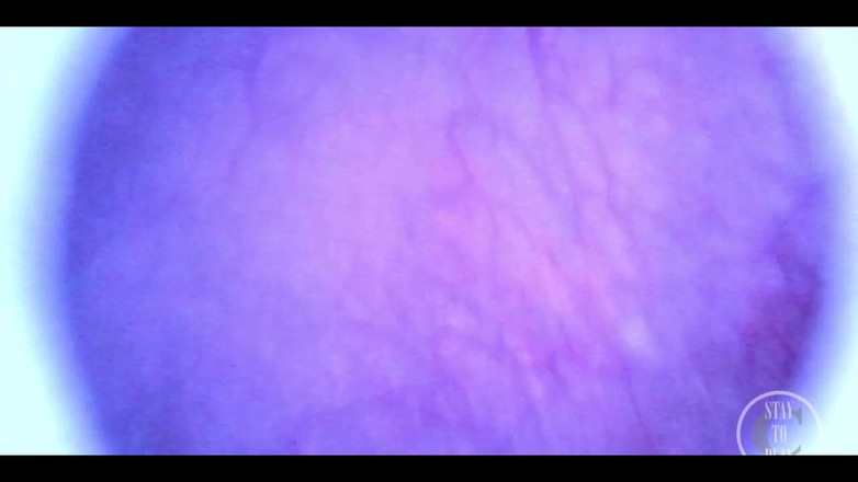 Lina Free: Beautiful Inside POV of My Full Bladder with the Endoscope!