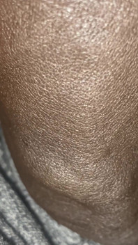 Meat Teaser