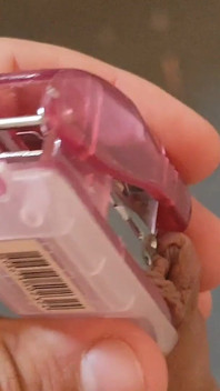 Intense Pleasure Stapling Phimosis.