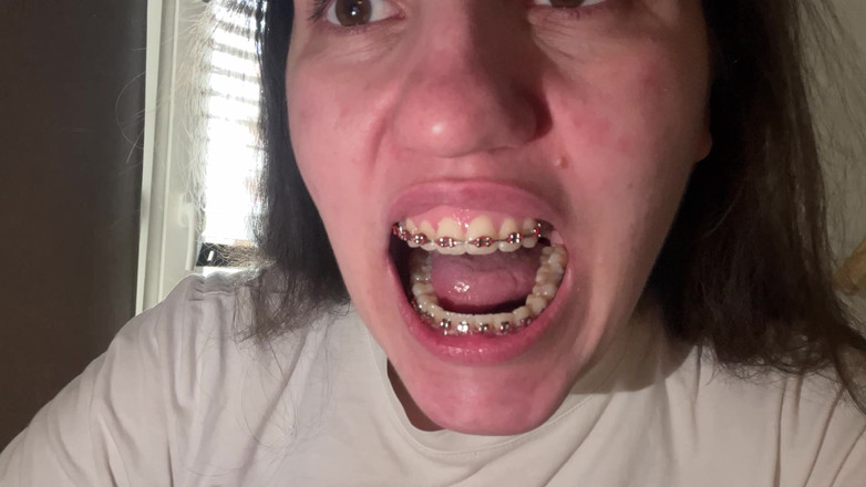 NicoleRay: Mit der Zunge die Zahnspangen lecken