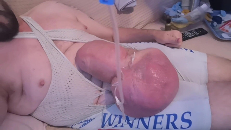 Monster_Meat_: Napełnianie 2 litrami glukozy