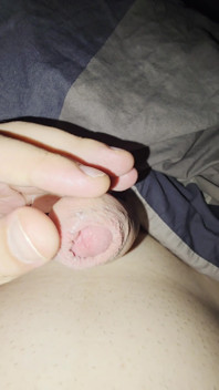 Tease