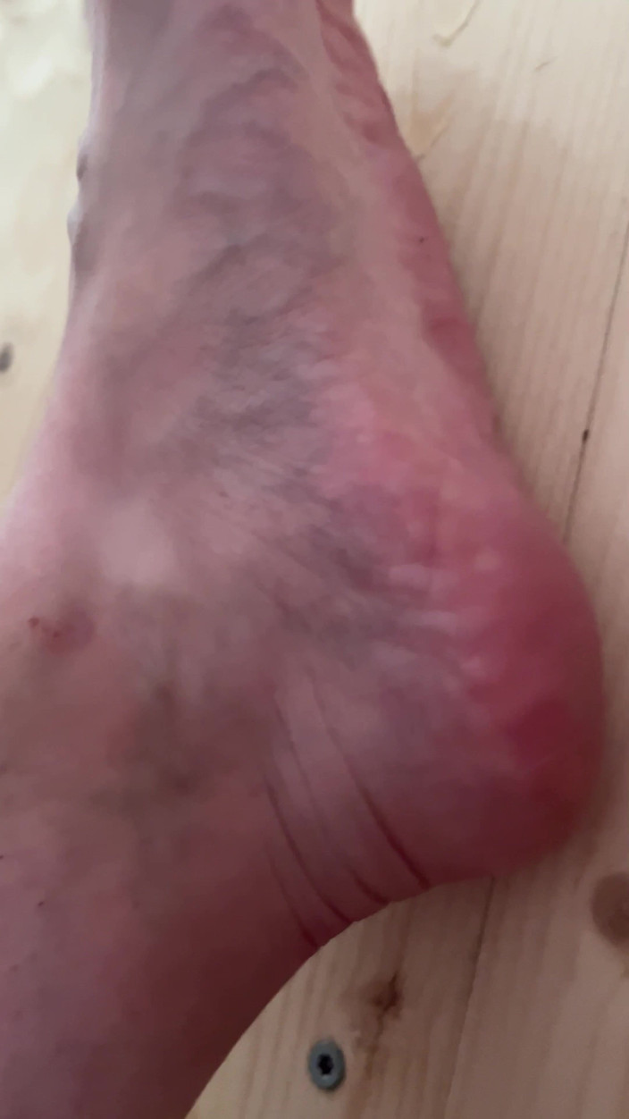 Feet: नंगे पैर चलना