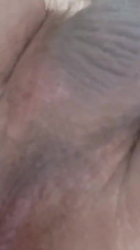 Meu anal