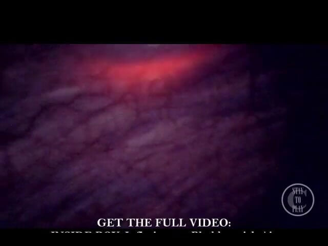 Lina Free: 632750815664152576