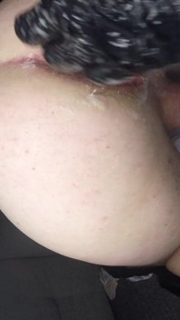 Duplo punho anal