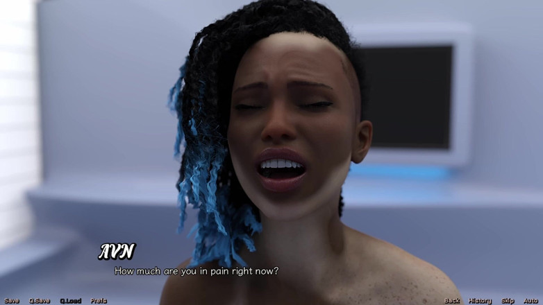 AVN Teller: Stranded in Space - menina vitiligo que está apaixonada pelo meu...