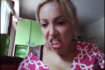 savannahamatoriale: Beautiful Face, but Rotten Teeth!