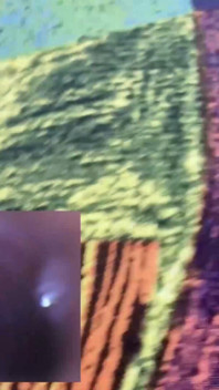 Wallowing a Pill Cam While Walking Inside My Stomach POV