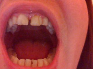 Nicoletta Fetish: Vore cu fetiș cu dinți
