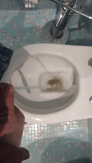 Bayer911: POV chcaní na záchodě