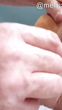 Anal Polishing