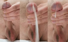 विशाल कमशॉट फ्रंटल