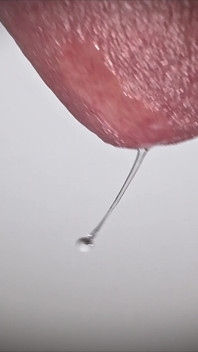 Penis Tropft