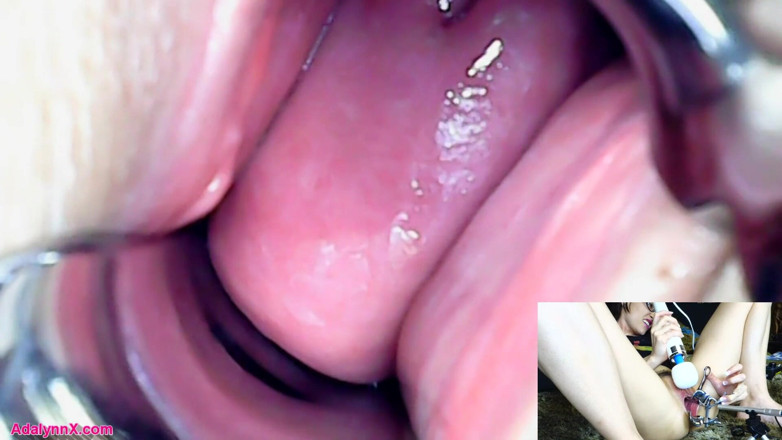 AdalynnX: AdalynnX - Endoscope speculum hitachi vib