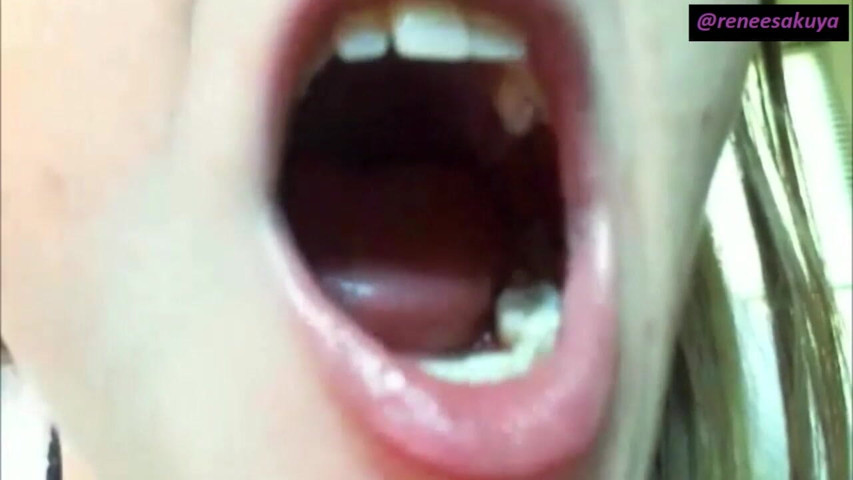 Upclose Inside My Mouth (Renee Sakuyas Studio)
