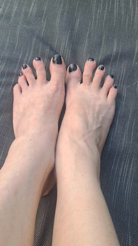 Do We See How Beguiled My Throbbing Foot Veins Are