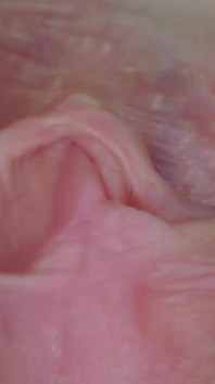 Klitoris och vagina