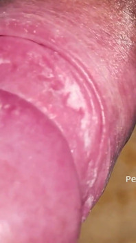 Smegma During Masturbation Part 02