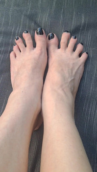 Do We See How Beguiled My Throbbing Foot Veins Are