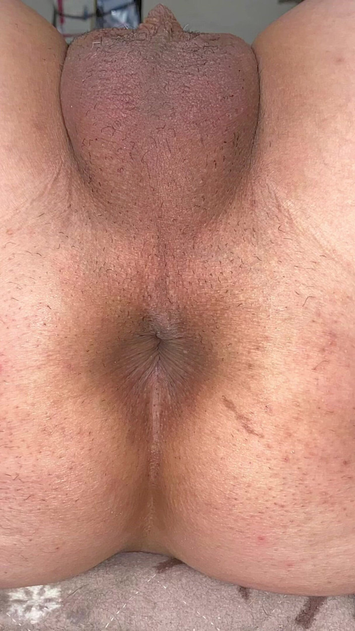 Kyotosigakk: Un uomo mostra il culo e il suo buco del...