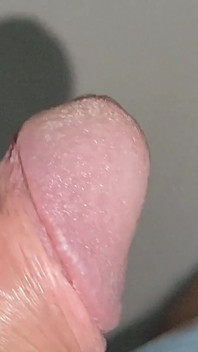 Garoto De Grande Fimose Anal Excitada!
