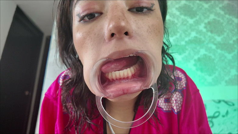 KiyuSweetCrazy: Cheeks Pulled Apart Teeth Exposed