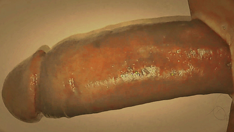 Sex art straight: Sappige lolly, ondergedompeld in witte chocolade. Wie wil er aan...