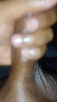 1000017835