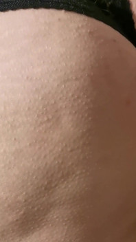 Ass Here