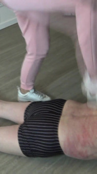 Old Patient Kicked by Home Help