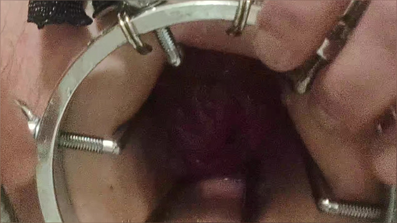 SergeyToys: Lavman, anal duş. Anal aynadan yakın çekim görünümü. Suyla anal seks....