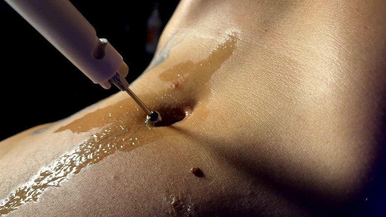 Navel fans: Mechanika bellybuttonu